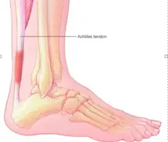 How to Stop Boots from Rubbing Heels, Top of Foot, Achilles, Ankle ...