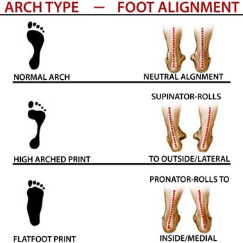 high-foot-arch