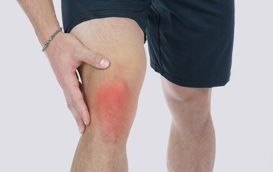 Knee_Bursitis_Pain